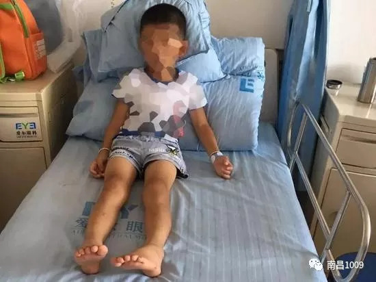 挖眼案男孩的求学之路，双学位的梦想与挑战
